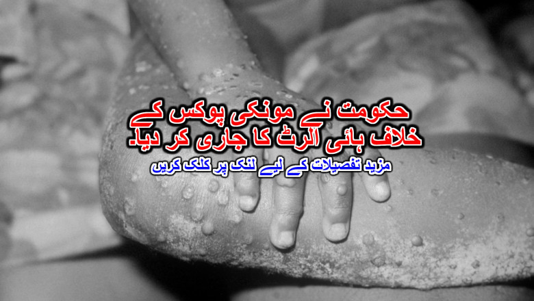حکومت نے مونکی پوکس کے خلاف ہائی الرٹ کا جاری کر دیا۔