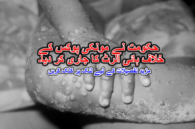 حکومت نے مونکی پوکس کے خلاف ہائی الرٹ کا جاری کر دیا۔