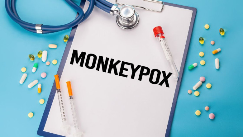 Monkeypox Confirmed in Two People in Pakistan, More Dangerous Epidemic than Corona Began to Rise